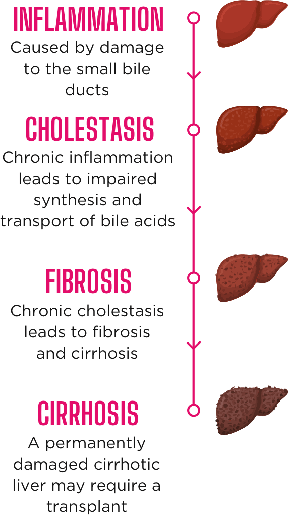 Inflammation, cholestasis, fibrosis, cirrhosis 